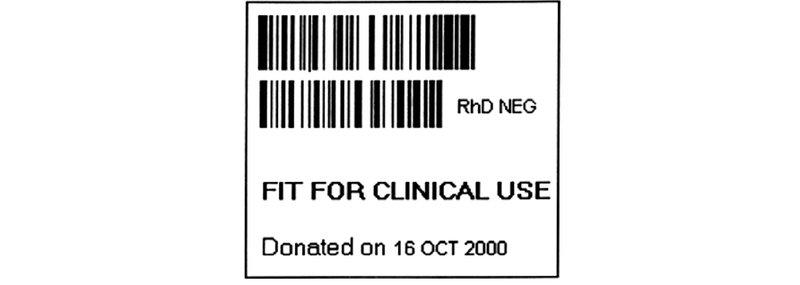A diagram showing an example of a tissue release status label which includes the product barcode, text giving information about the tissue product and the date of donation. Following the diagram is a description.