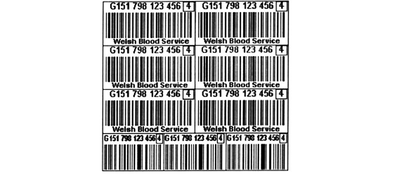 A diagram showing examples of donation identification numbers for tissue products. Following the diagram is a description.